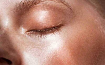 Rosacea Triggers and How to Avoid Them