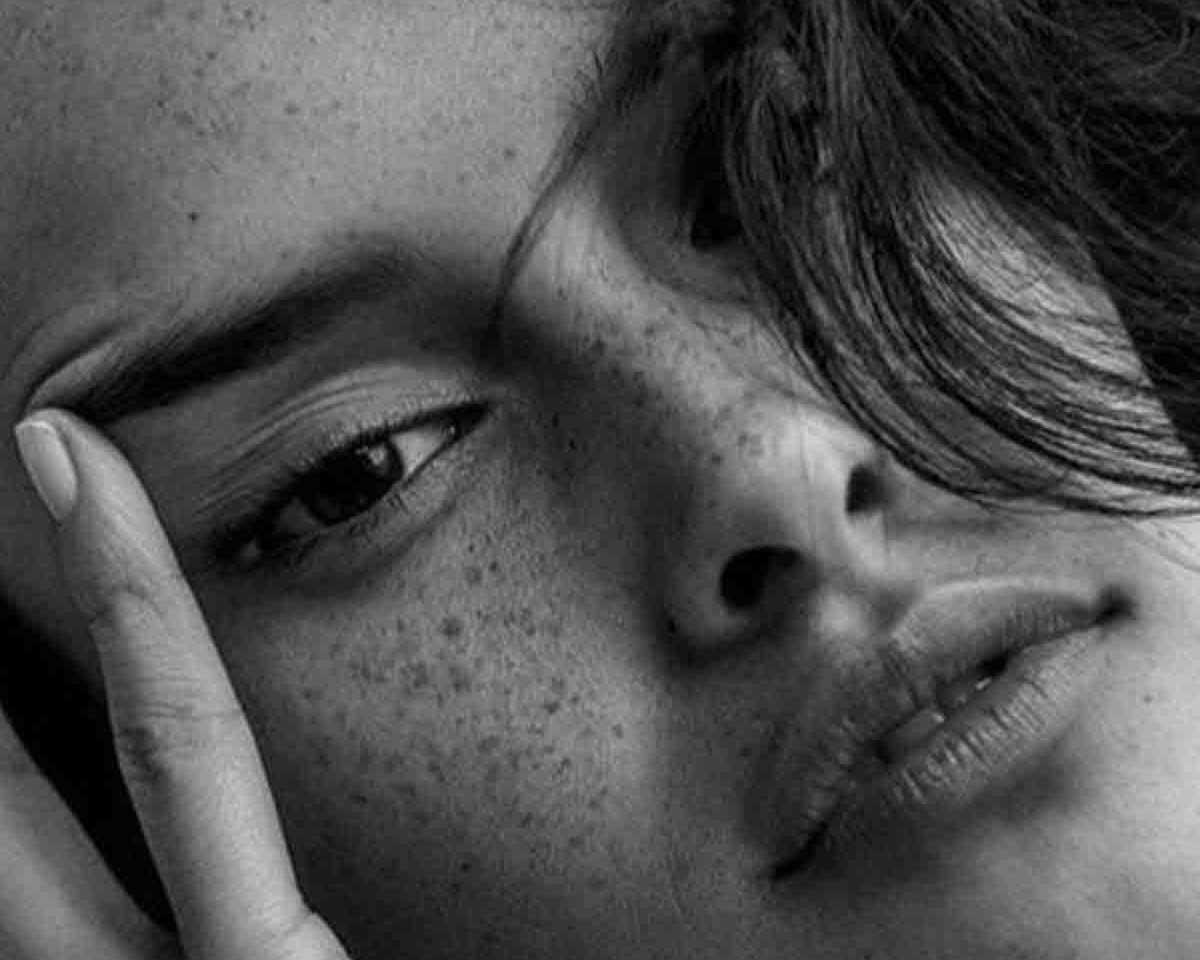 black and white cover image of the article 10 Surprising Acne Triggers You Need to Know About showing a beautiful girl