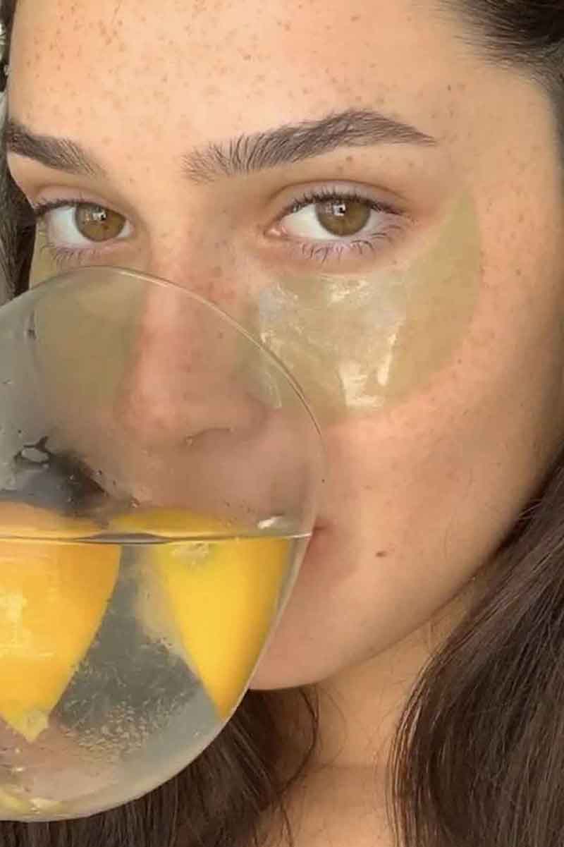 image of a girl with an under eye treatment to reduce eye bags