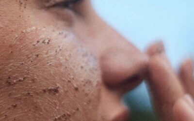 Enzymatic Exfoliation for Brighter, Smoother Skin